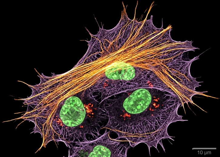 Electron microscopy image related to clathrin-coated structures